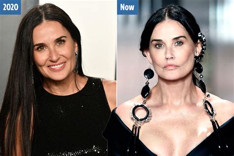 demi moore plastic surgery unrecognizable.